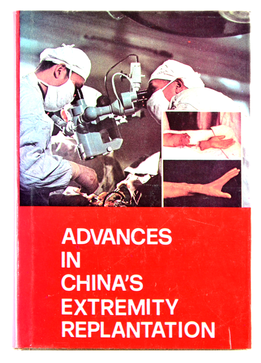 Advances in China's extremity replantation
