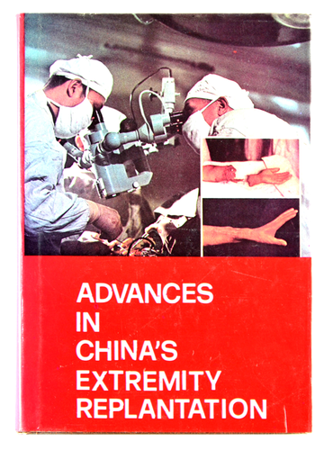 Advances in China's extremity replantation