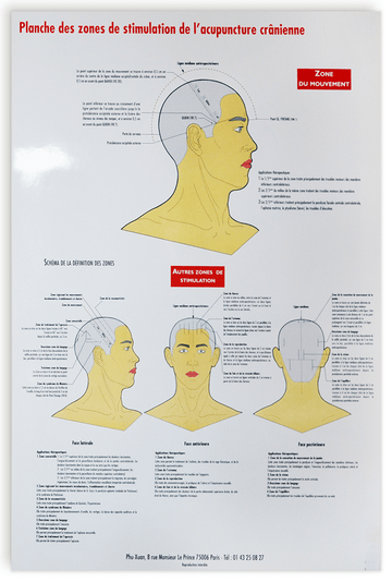 Planche des Zones de stimulation de l'acupuncture cranienne
