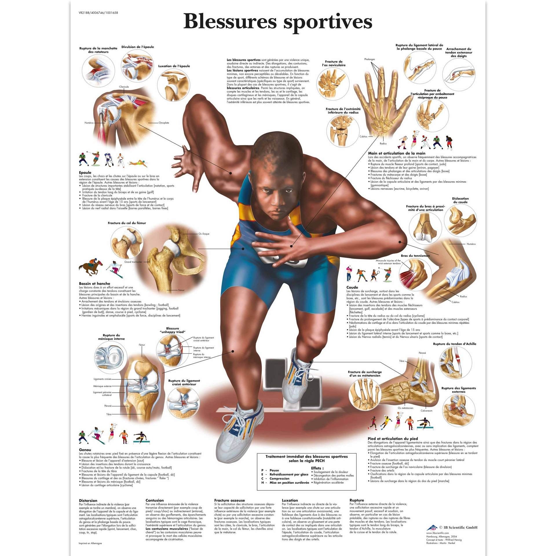 Blessures sportives, Planche, 20"x26", (50 x 67 cm) Français