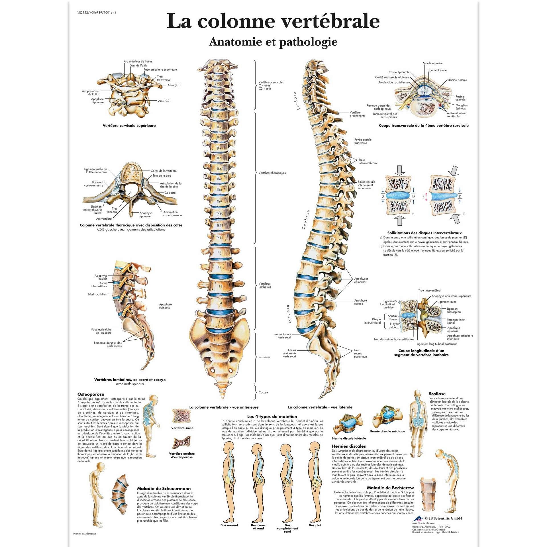 La colonne vertébrale, Anatomie et pathologie, Planche, 20"x26", (50 x 67 cm) Français