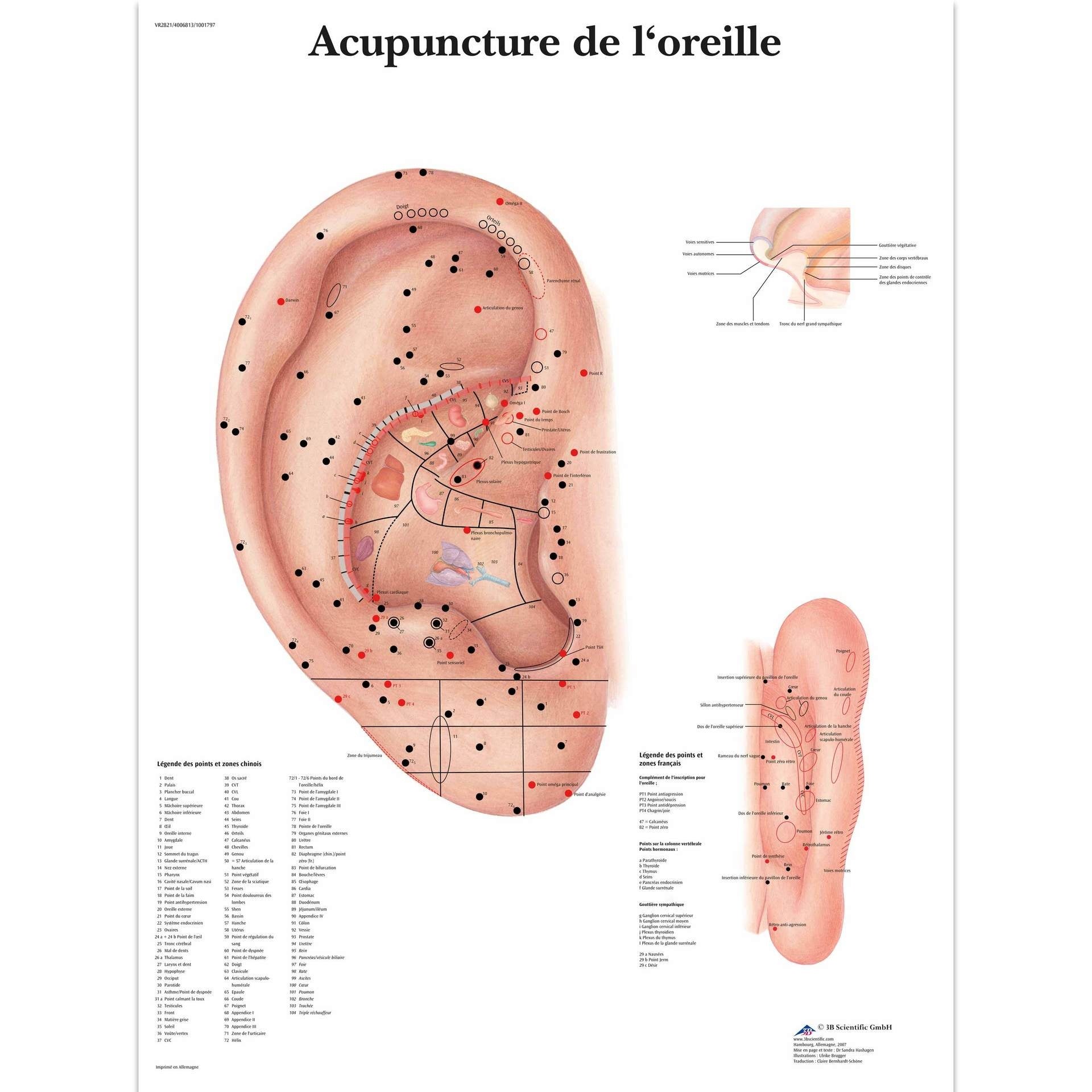 L’acupuncture de l'oreille, Planche, 20"x26", (50 x 67 cm) Français