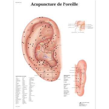 L’acupuncture de l'oreille, Planche, 20"x26", (50 x 67 cm) Français