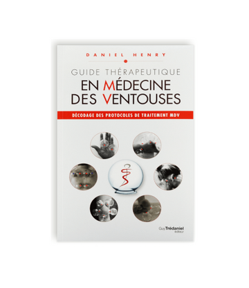 Guide thérapeutique en Médecine des ventouses